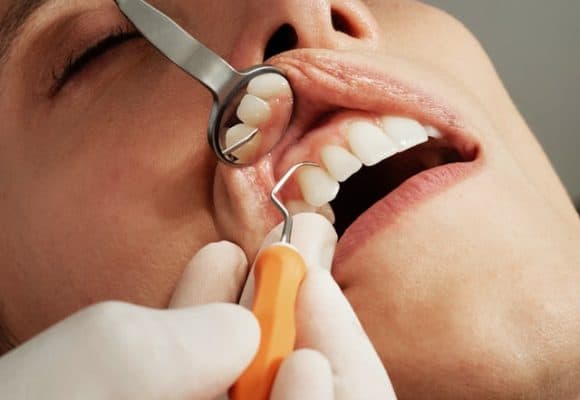 Oral Hygiene Tips and Techniques for a Healthy Smile